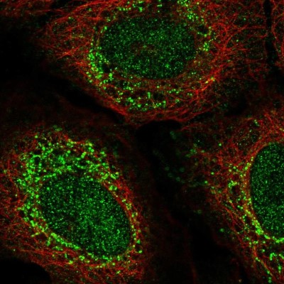Immunocytochemistry/Immunofluorescence: TBX4 Antibody [NBP2-58195] - Staining of human cell line U-2 OS shows localization to nucleoplasm & vesicles.