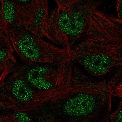 Immunocytochemistry/Immunofluorescence: TAF9 Antibody [NBP2-58070] - Staining of human cell line SK-MEL-30 shows localization to nucleoplasm.