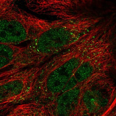 Immunocytochemistry/Immunofluorescence: TTI1 Antibody [NBP2-57828] - Staining of human cell line CACO-2 shows localization to nucleoplasm & vesicles.