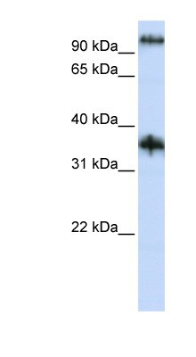 Western Blot: C9orf4 Antibody [NBP1-59961] - Jurkat cell lysate, concentration 0.2-1 ug/ml.