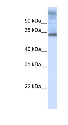Western Blot: C3orf17 Antibody [NBP1-59920] - 721_B cell lysate, concentration 0.2-1 ug/ml.