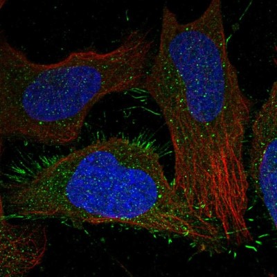 Immunocytochemistry/Immunofluorescence: CALCRL Antibody [NBP2-58137] - Staining of human cell line U-2 OS shows localization to plasma membrane.