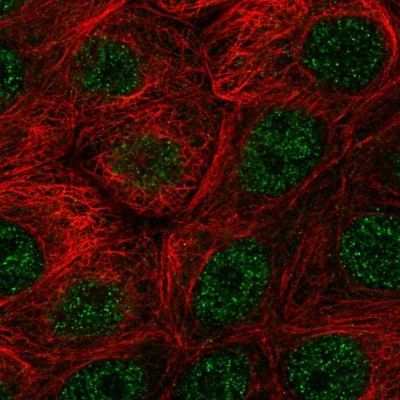Immunocytochemistry/Immunofluorescence: EY Cadherin Antibody [NBP2-58402] - Staining of human cell line MCF7 shows localization to nucleoplasm.