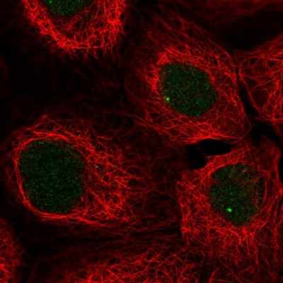 Immunocytochemistry/Immunofluorescence: SNAPC3 Antibody [NBP2-58320] - Staining of human cell line A-431 shows localization to nuclear bodies.
