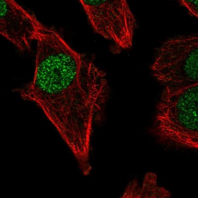 Immunocytochemistry/Immunofluorescence: DNA polymerase mu Antibody [NBP2-58506] - Staining of human cell line PC-3 shows localization to nucleoplasm.