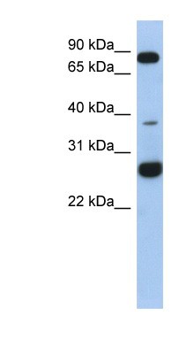 Western Blot: C1orf110 Antibody [NBP1-70448] - Titration: 0.2-1 ug/ml, Positive Control: Human heart.