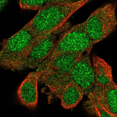 Immunocytochemistry/Immunofluorescence: BACH2 Antibody [NBP2-58464] - Staining of human cell line SH-SY5Y shows localization to nucleus & cytosol.