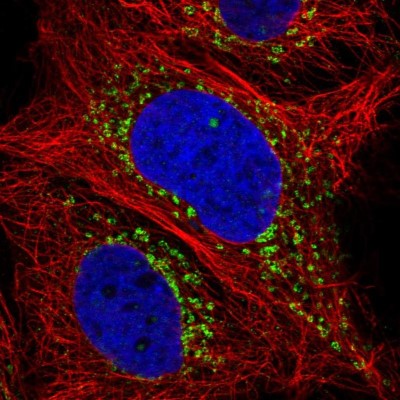 Immunocytochemistry/Immunofluorescence: Renal Cell Carcinoma (gp200) Antibody [NBP2-58339] - Staining of human cell line CACO-2 shows localization to the Golgi apparatus.