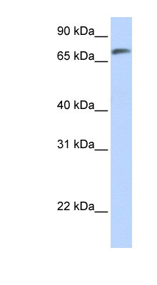 Western Blot: C14orf37 Antibody [NBP1-70435] - Titration: 0.2-1 ug/ml, Positive Control: Human Lung.