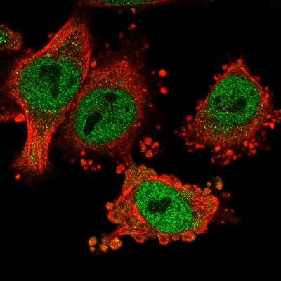 Immunocytochemistry/Immunofluorescence: HMBOX1 Antibody [NBP2-58377] - Staining of human cell line U-251 MG shows localization to nucleoplasm & cytosol.