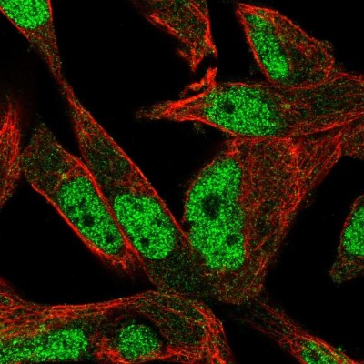 Immunocytochemistry/Immunofluorescence: POLN Antibody [NBP2-58780] - Staining of human cell line RH-30 shows localization to nucleoplasm.