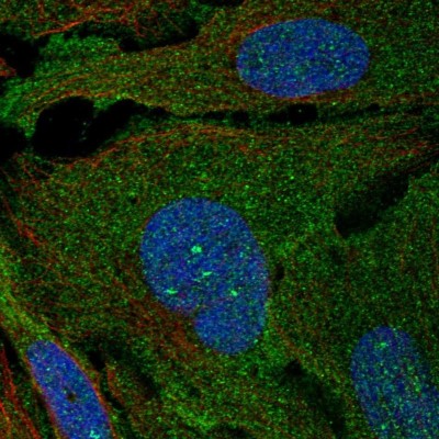 Immunocytochemistry/Immunofluorescence: ARHGAP19 Antibody [NBP2-58729] - Staining of human cell line U-2 OS shows localization to plasma membrane.