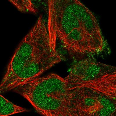 Immunocytochemistry/Immunofluorescence: FBXO41 Antibody [NBP2-58157] - Staining of human cell line RH-30 shows localization to nucleus & cytosol.