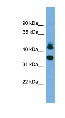 Western Blot: Sorting Nexin 32 Antibody [NBP1-79591] - NCI-H226 cell lysate, concentration 0.2-1 ug/ml.