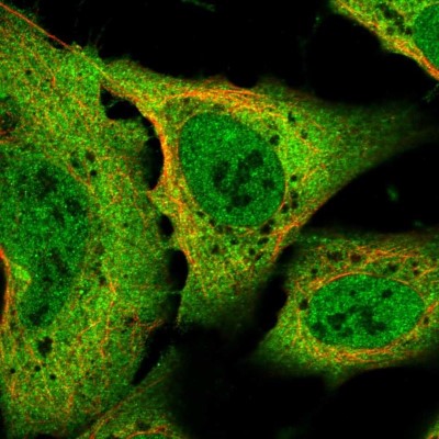 Immunocytochemistry/Immunofluorescence: Sodium Calcium Exchanger 1/NCX1 Antibody [NBP2-56483] - Staining of human cell line U-2 OS shows localization to nucleoplasm & plasma membrane.