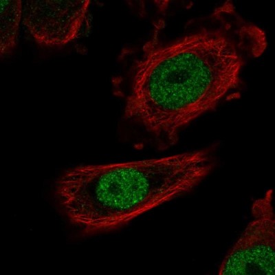 Immunocytochemistry/Immunofluorescence: ZHX1 Antibody [NBP2-56728] - Staining of human cell line PC-3 shows localization to nucleoplasm.