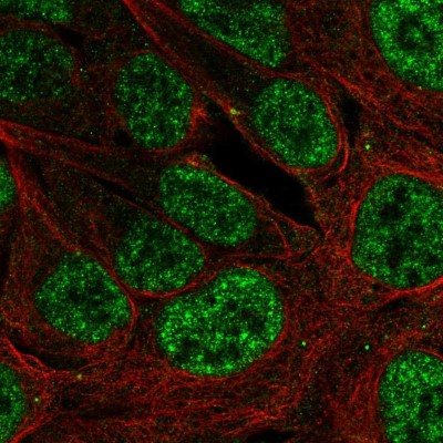 Immunocytochemistry/Immunofluorescence: PLAG1 Antibody [NBP2-56656] - Staining of human cell line U-2 OS shows localization to nuclear speckles.
