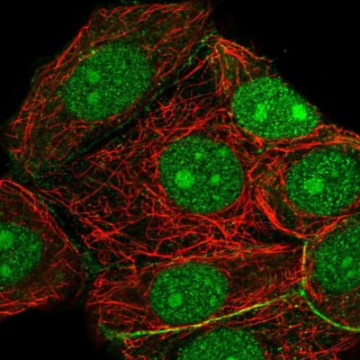 Immunocytochemistry/Immunofluorescence: RRP7A Antibody [NBP2-56719] - Staining of human cell line MCF7 shows localization to nucleus, nucleoli & cell junctions.