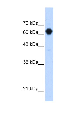 Western Blot: C3orf39 Antibody [NBP1-79305] - HepG2 cell lysate, concentration 1.25ug/ml.