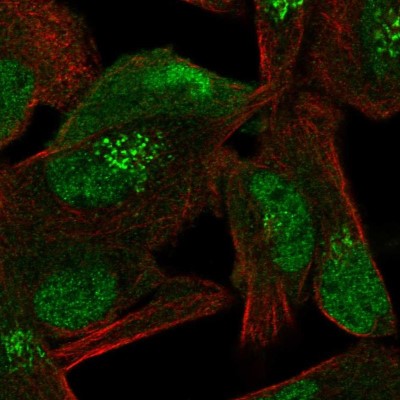 Immunocytochemistry/Immunofluorescence: TIP120A Antibody [NBP2-56630] - Staining of human cell line RH-30 shows localization to nucleoplasm, cytosol & the Golgi apparatus.