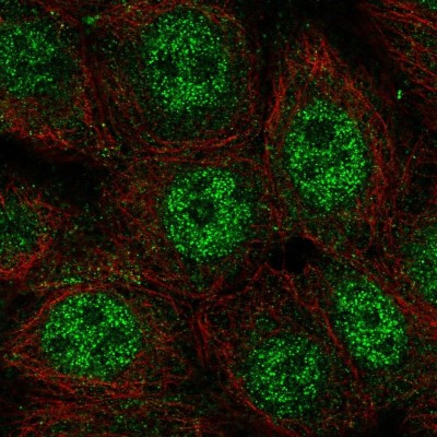 Immunocytochemistry/Immunofluorescence: wdyhv1 Antibody [NBP2-58578] - Staining of human cell line MCF7 shows localization to nucleoplasm.
