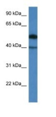 Western Blot: C9orf64 Antibody [NBP1-91506] - Titration: 1.0 ug/ml Positive Control: COLO205 Whole Cell.