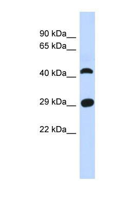Western Blot: C4orf22 Antibody [NBP1-56792] - Human Muscle lysate, concentration 0.2-1 ug/ml.