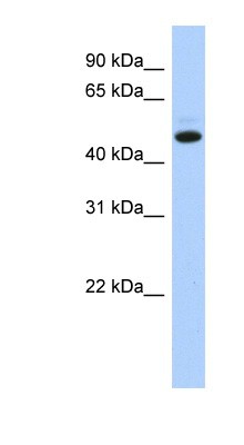 Western Blot: C5orf36 Antibody [NBP1-56799] - Hela cell lysate, concentration 0.2-1 ug/ml.