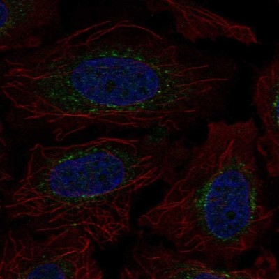 Immunocytochemistry/Immunofluorescence: Ext2 Antibody [NBP2-58869] - Staining of human cell line SiHa shows localization to the Golgi apparatus.