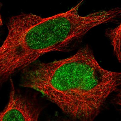 Immunocytochemistry/Immunofluorescence: FAM13B1 Antibody [NBP2-58978] - Staining of human cell line U-2 OS shows localization to nucleoplasm.