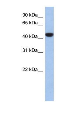 Western Blot: C2orf53 Antibody [NBP1-91464] - 721_B cell lysate, concentration 0.2-1 ug/ml.
