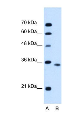 Western Blot: Activin Receptor Type 2B Antibody [NBP1-59708] - Activin Receptor Type 2B Antibody HepG2 cell lysate, concentration 0.2-1 ug/ml.