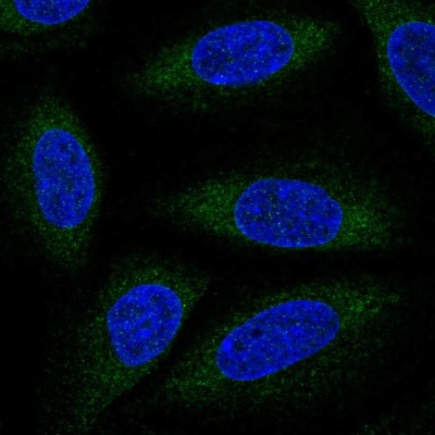 Immunocytochemistry/Immunofluorescence: ALG6 Antibody [NBP2-56400] - Staining of human cell line SiHa shows localization to endoplasmic reticulum.