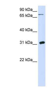 Western Blot: Uridine Phosphorylase 1/UPP1 Antibody [NBP1-55354] -  293T cells lysate, concentration 0.2-1 ug/ml.