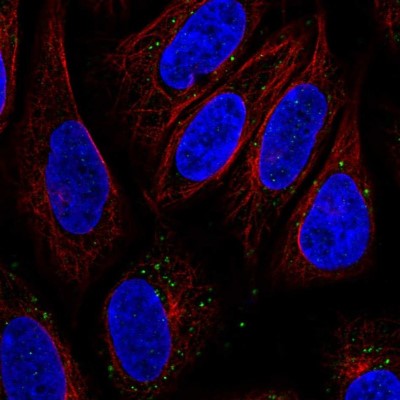 Immunocytochemistry/Immunofluorescence: SLC15A3 Antibody [NBP2-56960] - Staining of human cell line SiHa shows localization to vesicles.