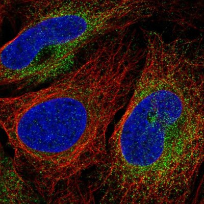 Immunocytochemistry/Immunofluorescence: SCARA3 Antibody [NBP2-56837] - Staining of human cell line U-2 OS shows localization to endoplasmic reticulum.