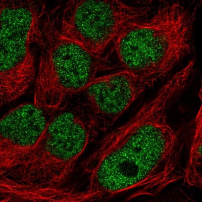 Immunocytochemistry/Immunofluorescence: GMEB2 Antibody [NBP2-56893] - Staining of human cell line CACO-2 shows localization to nucleoplasm.