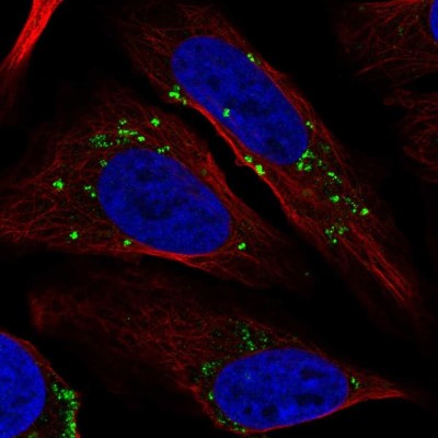 Immunocytochemistry/Immunofluorescence: TIN-Ag Antibody [NBP2-58938] - Staining of human cell line U-2 OS shows localization to vesicles.