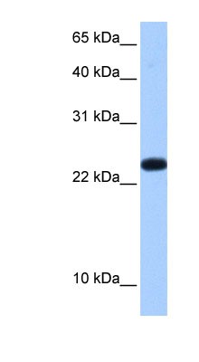 Western Blot: C19orf24 Antibody [NBP1-57556] - Human Placenta lysate, concentration 0.2-1 ug/ml.