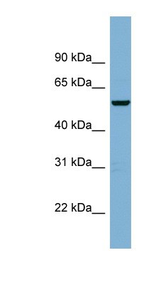 Western Blot: C2orf29 Antibody [NBP1-56529] - MCF-7 whole cell lysates, concentration 0.2-1 ug/ml.