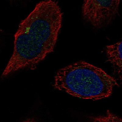 Immunocytochemistry/Immunofluorescence: beta-1,4-Galactosyltransferase 2/B4GalT2 Antibody [NBP2-58906] - Staining of human cell line U-2 OS shows localization to the Golgi apparatus.