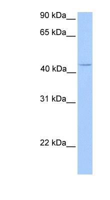 Western Blot: C17orf97 Antibody [NBP1-70443] - Jurkat cell lysate, concentration 0.2-1 ug/ml.