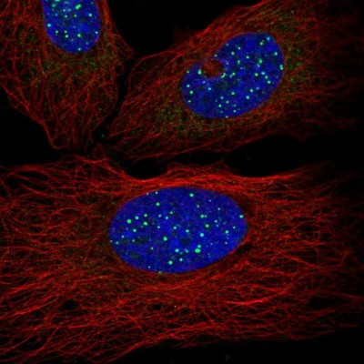 Immunocytochemistry/Immunofluorescence: TIN2 Antibody [NBP2-56834] - Staining of human cell line U-2 OS shows localization to nuclear bodies.