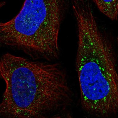 Immunocytochemistry/Immunofluorescence: FYCO1 Antibody [NBP2-58241] - Staining of human cell line U-2 OS shows localization to vesicles.