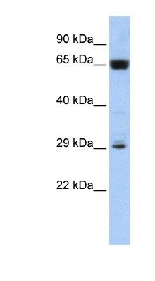 Western Blot: C6orf223 Antibody [NBP1-70477] - Titration: 0.2-1 ug/ml, Positive Control: Jurkat cell lysate.