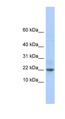 Western Blot: C9orf25 Antibody [NBP1-70482] - Jurkat cell lysate, concentration 0.2-1 ug/ml.