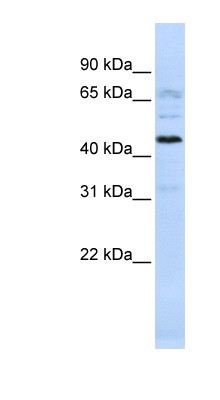 Western Blot: C22orf9 Antibody [NBP1-70465] - 721_B cell lysate, concentration 0.2-1 ug/ml.