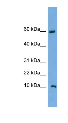 Western Blot: C20orf144 Antibody [NBP1-70460] - NCI-H226 cell lysate, concentration 0.2-1 ug/ml.