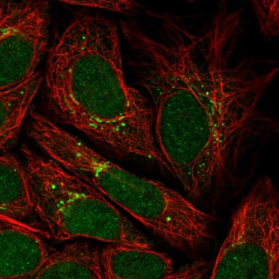 Immunocytochemistry/Immunofluorescence: G5pr Antibody [NBP2-58168] - Staining of human cell line SiHa shows localization to nucleoplasm & the Golgi apparatus.