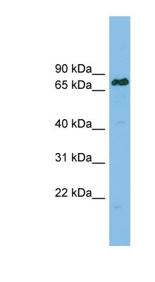 Western Blot: Lamin B Receptor Antibody [NBP1-59845] - RPMI 8226 cell lysate, concentration 0.2-1 ug/ml.